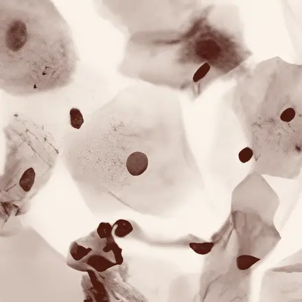 Células vistas ao microscópio, em lâmina de citologia